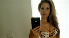 S výsledkem je Jitka spokojená i čtyři roky po operaci. S výsledkem je Jitka spokojená i čtyři roky po operaci.