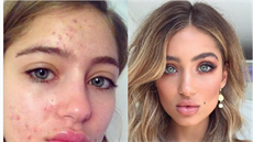 Australská modelka Belle Lucia se na sociálních sítích svěřila s tím, že ji... Australská modelka Belle Lucia se na sociálních sítích svěřila s tím, že ji...