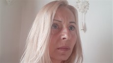 Lenka tři roky po operaci Lenka tři roky po operaci