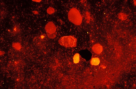 Mycobacterium tuberculosis - bakterie, která způsobuje tuberkulózu.