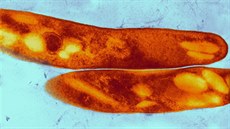 Mycobacterium tuberculosis  bakterie, která zpsobuje tuberkulózu.