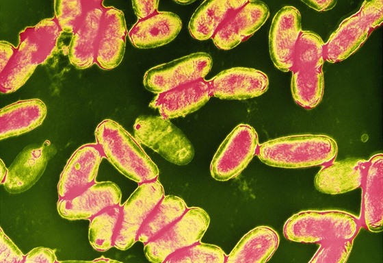 Bakterie Bordetella pertussis, která zpsobuje vysoce nakalivý erný kael.