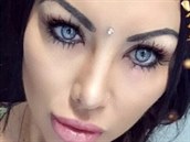 Modelka Nadinne Bruna kvůli plastické operaci očí málem přišla o zrak. Modelka Nadinne Bruna kvůli plastické operaci očí málem přišla o zrak.