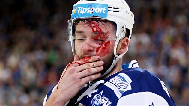 Krvav zrann brnnskho hokejisty Radima Zohorny.