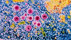 cytomegalovirus, virus cytomegalovirus, virus