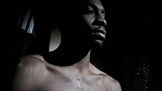 Jeff Green nosí na hrudi jizvu, která mu připomíná operaci srdce. Jeff Green nosí na hrudi jizvu, která mu připomíná operaci srdce.