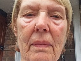 Pauline, 78 let