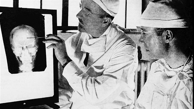 Lobotomii se vnoval napklad Walter Freeman (vlevo) a James W. Watts.  V roce 1941 i jejich operacch informoval list Saturday Evening Post.