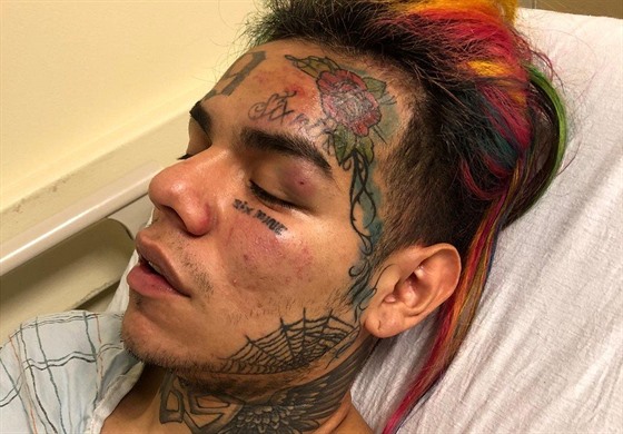 Raper Tekashi69 po útoku skonil v nemocnici (New York, 22. ervence 2018).