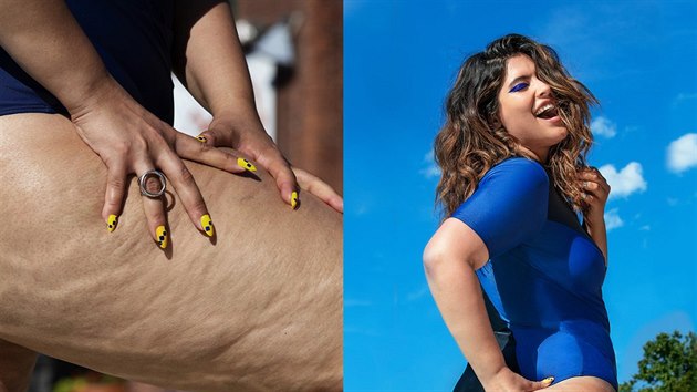 Celulitida je v podku ukzala kampa americkho obchodu se sportovn mdou a plavkami Chromat.