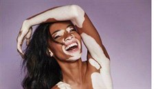 Modelka Winnie Harlowová má poruchu koního pigmentu známou jako vitiligo....