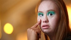 Model Madeline Stuart, who has Down's syndrome, is prepared backstage before... Model Madeline Stuart, who has Down's syndrome, is prepared backstage before...