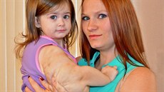 Lékaři dnes znají celkem sedm tisíc vzácných onemocnění a asi 80 procent z nich... Lékaři dnes znají celkem sedm tisíc vzácných onemocnění a asi 80 procent z nich...