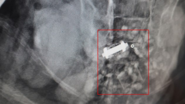 Zhadn pedmt, kter zvec zchrani odhalili pi rentgenovn v zavacm traktu zrannho a tce ltajcho orla moskho v jezdu u Chanovic. (28. jna 2018)