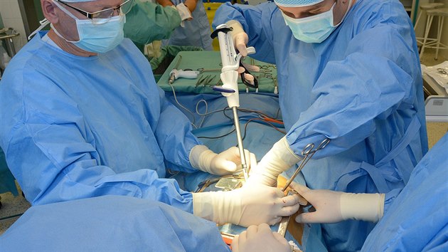Pacient Fakultn nemocnice u sv. Anny v Brn pi operaci ndoru na plci dchal pomoc mimotlnho obhu ECMO.