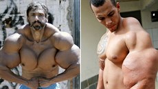 Pyšní se obřími svaly na rukou, nohou i zádech a přitom nemuseli vůbec chodit... Pyšní se obřími svaly na rukou, nohou i zádech a přitom nemuseli vůbec chodit...