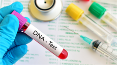 vzorek DNA (ilustrační foto) vzorek DNA (ilustrační foto)
