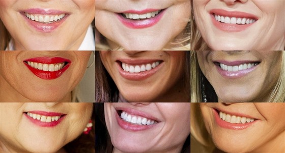 KVÍZ: Poznáte celebrity podle úsmvu?