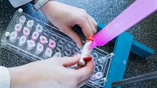 Čeští vědci vynalezli látku, která účinkuje i na kmeny tuberkulózy odolné proti... Čeští vědci vynalezli látku, která účinkuje i na kmeny tuberkulózy odolné proti...