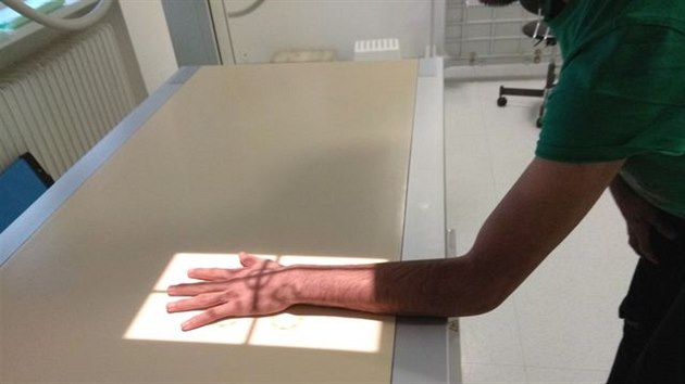 Pravděpodobný věk cizinců určil až lékař na základě rentgenových snímků jejich rukou.