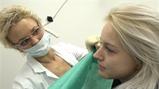 Ošetření očních víček pomocí IQ plasmy Ošetření očních víček pomocí IQ plasmy
