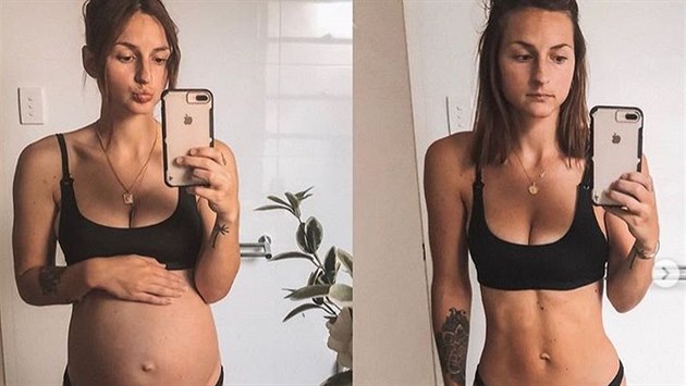 Nicole Knighttová - na první fotografii je v den porodu, na druhé deset dnů po... Nicole Knighttová - na první fotografii je v den porodu, na druhé deset dnů po...