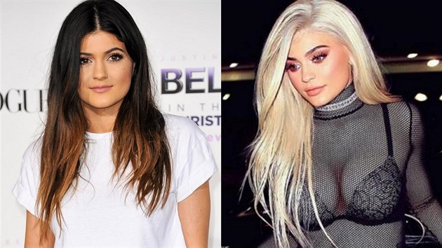 Kylie Jennerov se od roku 2013 dost zmnila. Pesto stle tvrd, e nepodstoupila dn plastick operace.