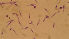 Parazitičtí prvoci Leishmania, které přenáší mouchy, způsobující onemocnění... Parazitičtí prvoci Leishmania, které přenáší mouchy, způsobující onemocnění...