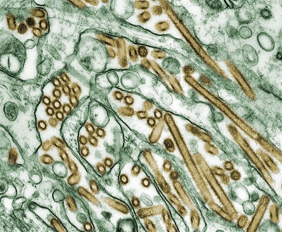 Kolorovaný snímek ástic viru H5N1 (zlaté ástice) v kultue ze savích bunk