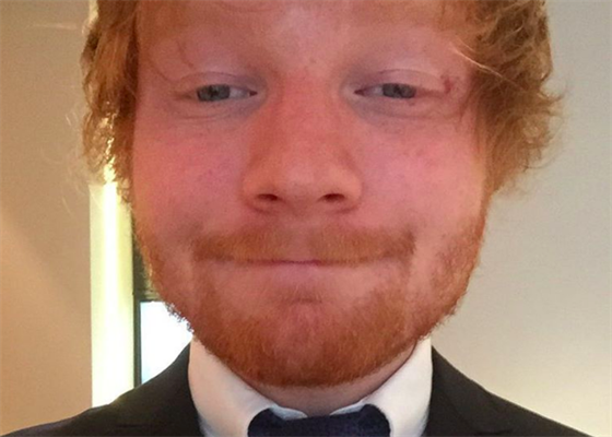 Ed Sheeran: V budoucnu se meme tit na osvdenou spolupráci!