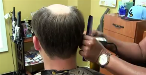 VIDEO: Podvod pro mue bez vlas
