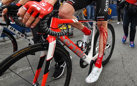 Krvavé zranní Toma Dumoulina, který ml ve tvrté etap Gira d'Italia nehodu.
