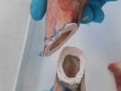Brněnští lékaři a vědci vyvíjí kostní lepidlo, které by rychleji zahojilo... Brněnští lékaři a vědci vyvíjí kostní lepidlo, které by rychleji zahojilo...
