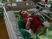 Adámek čtyři dny po operaci mandlí začal silně krvácet, minuty čekal na pomoc... Adámek čtyři dny po operaci mandlí začal silně krvácet, minuty čekal na pomoc...