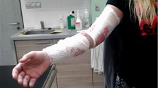 Zranění způsobená kočkou poměrně hodně krvácela. Zranění způsobená kočkou poměrně hodně krvácela.