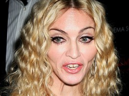 Madonnina mezírka mezi pedními zuby je asi nejznámjí. Zpvaku ani...