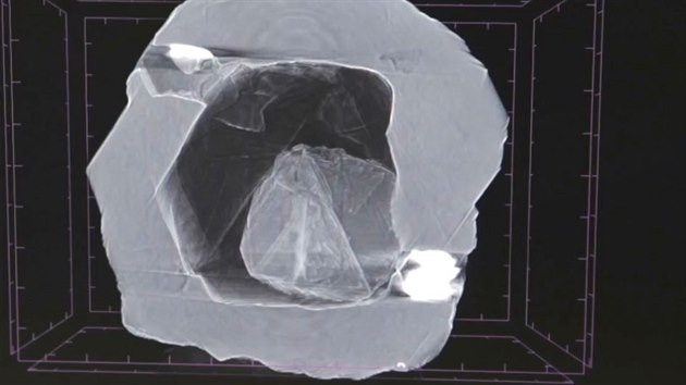 Na rentgenovm snmku je vidt men diamant v dutin vtho. (6. jna 2019)