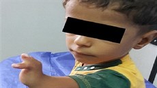 Snímek postiženého iráckého chlapce ze studie o zdravotních rizicích v okolí... Snímek postiženého iráckého chlapce ze studie o zdravotních rizicích v okolí...