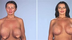 Krystina Butelová ped poslední operací (vlevo) a po operaci. 