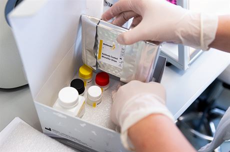 Nová léčba střev odhalí dříve nádory, bifidobakterie pomohou s omlazením Základem metody je sledování hladin několika takzvaných cirkulujících mikroRNA,... | na serveru Lidovky.cz | aktuální zprávy