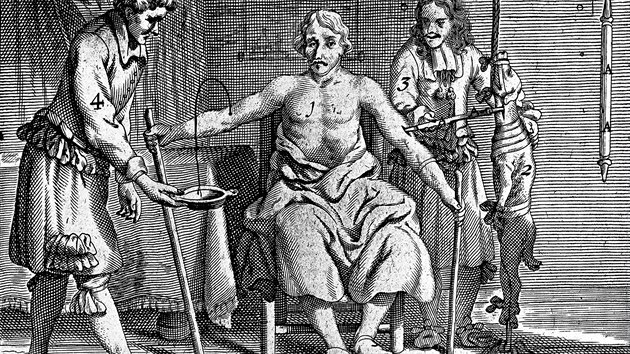 Pokusy s krevn transfuz od psa lovku z roku 1692