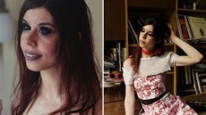 Žena přišla o zrak kvůli potetovanému bělmu Žena přišla o zrak kvůli potetovanému bělmu