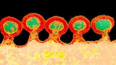 Virus HIV po 72 000násobném zvtení elektronovým mikroskopem (11. bezna 2020)