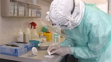 Nemocnice Tomáše Bati ve Zlíně začala 25. března 2020 využívat rychlotesty na... Nemocnice Tomáše Bati ve Zlíně začala 25. března 2020 využívat rychlotesty na...
