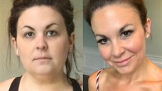Lisa Rothenbergová před hubnutím a po něm Lisa Rothenbergová před hubnutím a po něm