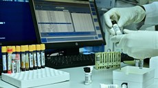 Antidopingová laboratoř Antidopingová laboratoř