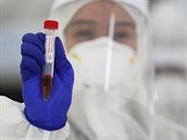 Filipínský zdravotník v ochranném obleku ukazuje odebraný vzorek pro testování...