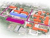 V Kroměřížské nemocnici vznikne monoblok za miliardu (ve vizualizaci vyznačený... V Kroměřížské nemocnici vznikne monoblok za miliardu (ve vizualizaci vyznačený...