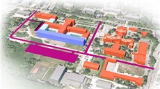 V Kroměřížské nemocnici vznikne monoblok za miliardu (ve vizualizaci vyznačený... V Kroměřížské nemocnici vznikne monoblok za miliardu (ve vizualizaci vyznačený...