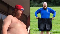 Za rok muž zhubl padesát kilogramů. Za rok muž zhubl padesát kilogramů.